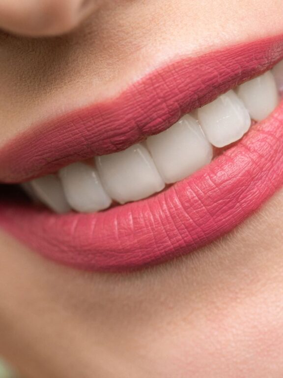 Quali sono le abitudini da evitare per salvaguardare i denti?
